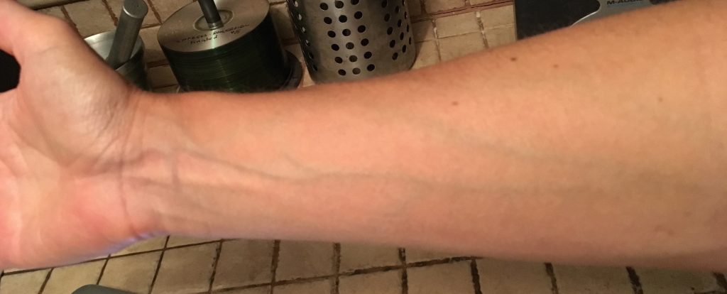Veiny arm with blue streaks.